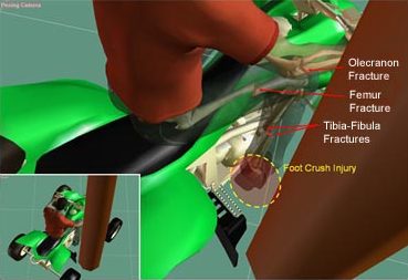 Reconstruction of the Injury Producing Event of an ATV Accident.